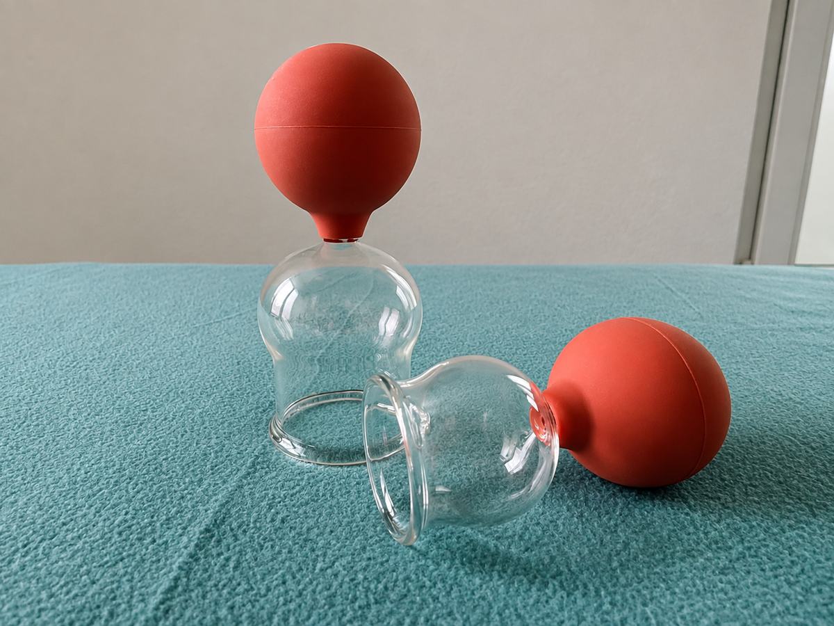 Schröpfgläser mit Saugball auf der Massageliege
